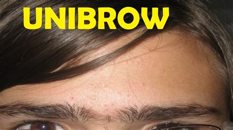 How to get rid of a unibrow. Things To Know About How to get rid of a unibrow. 